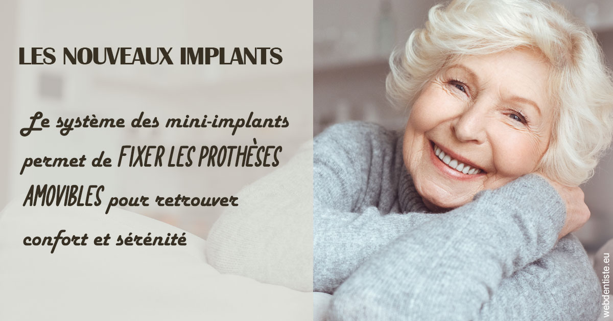 https://dr-alexandre-grau.chirurgiens-dentistes.fr/Les nouveaux implants 1