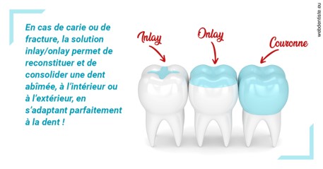 https://dr-alexandre-grau.chirurgiens-dentistes.fr/L'INLAY ou l'ONLAY