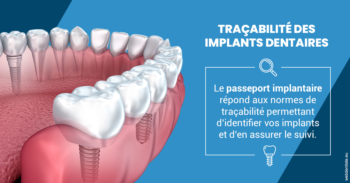 https://dr-alexandre-grau.chirurgiens-dentistes.fr/T2 2023 - Traçabilité des implants 1