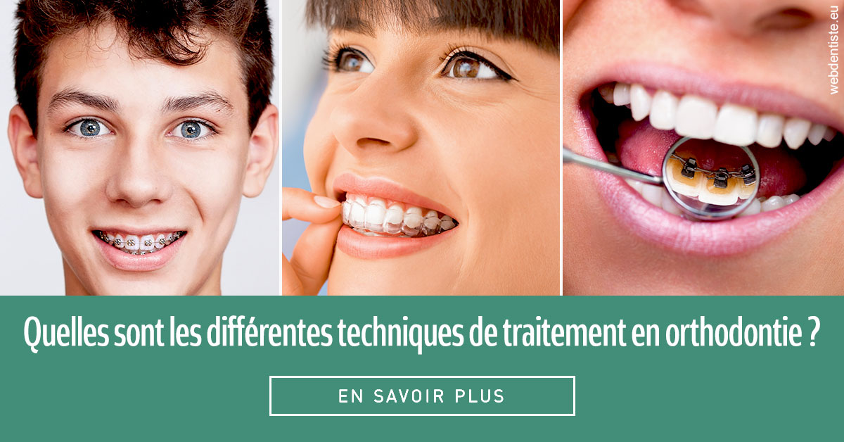 https://dr-alexandre-grau.chirurgiens-dentistes.fr/Les différentes techniques de traitement 2