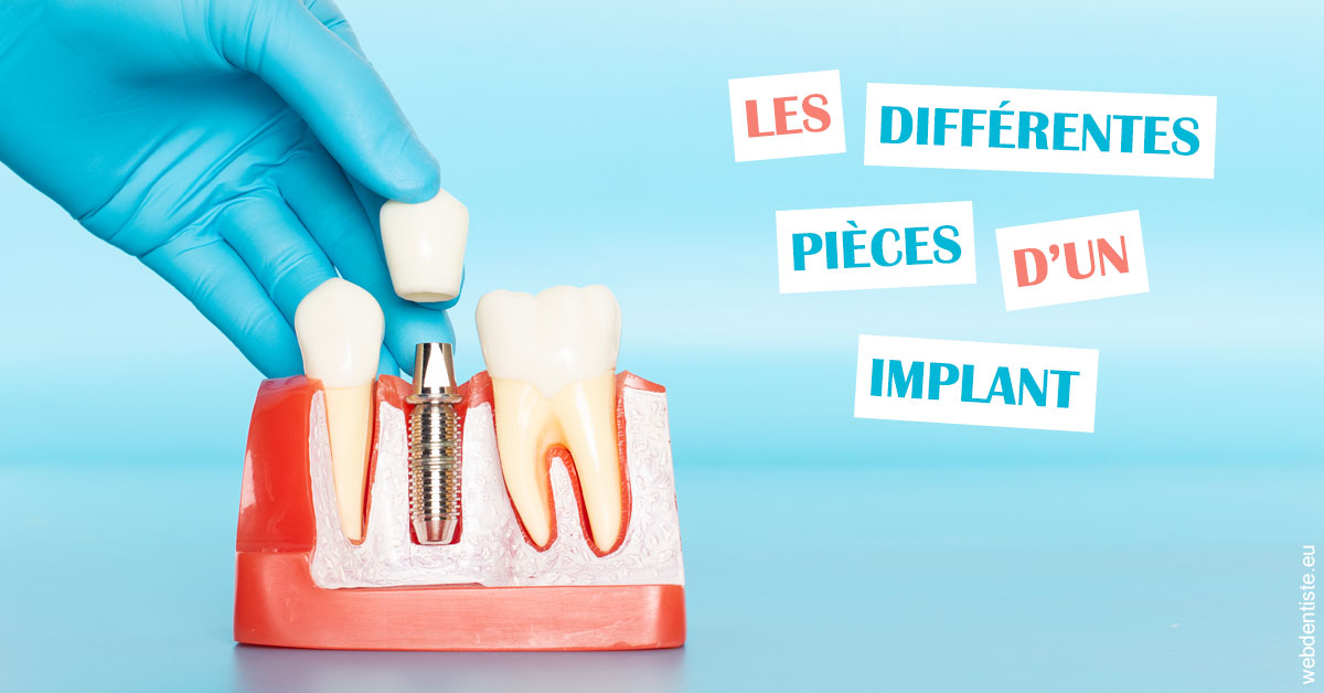 https://dr-alexandre-grau.chirurgiens-dentistes.fr/Les différentes pièces d’un implant 2