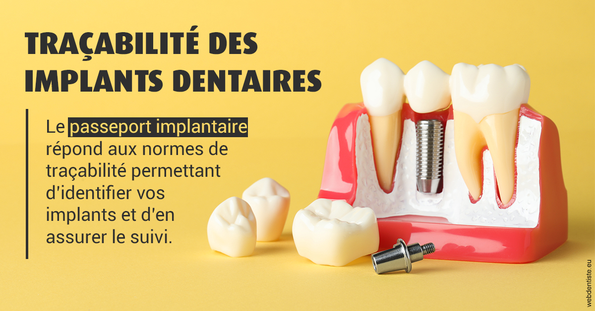 https://dr-alexandre-grau.chirurgiens-dentistes.fr/T2 2023 - Traçabilité des implants 2