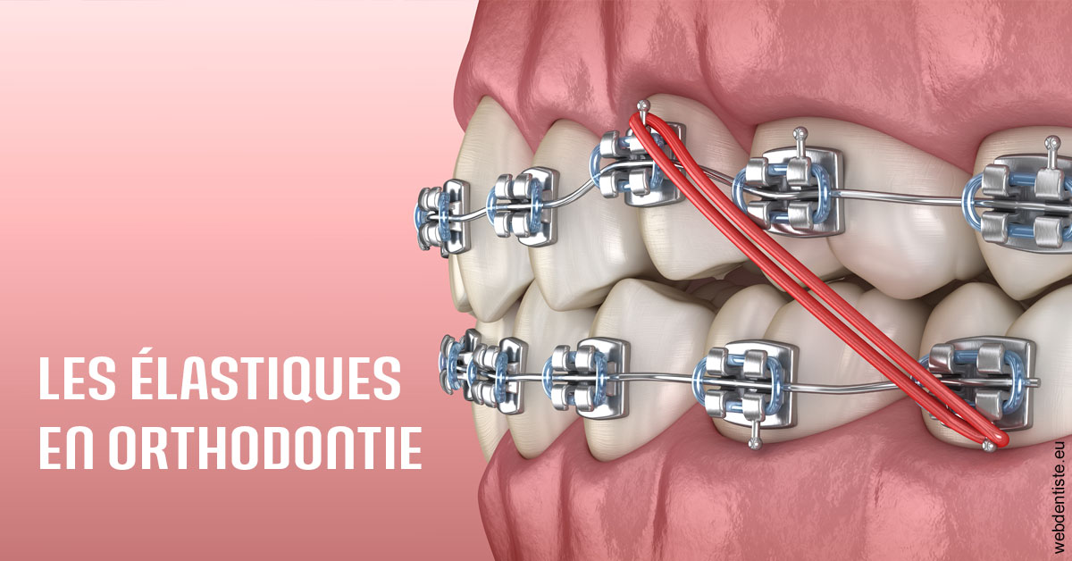 https://dr-alexandre-grau.chirurgiens-dentistes.fr/Elastiques orthodontie 2