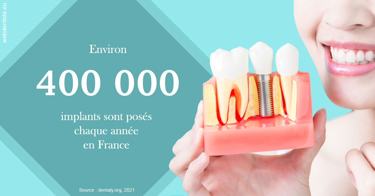 https://dr-alexandre-grau.chirurgiens-dentistes.fr/Pose d'implants en France 2
